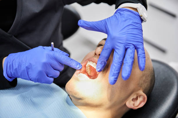 Best Emergency Dental Extractions in Fort Lee, VA
